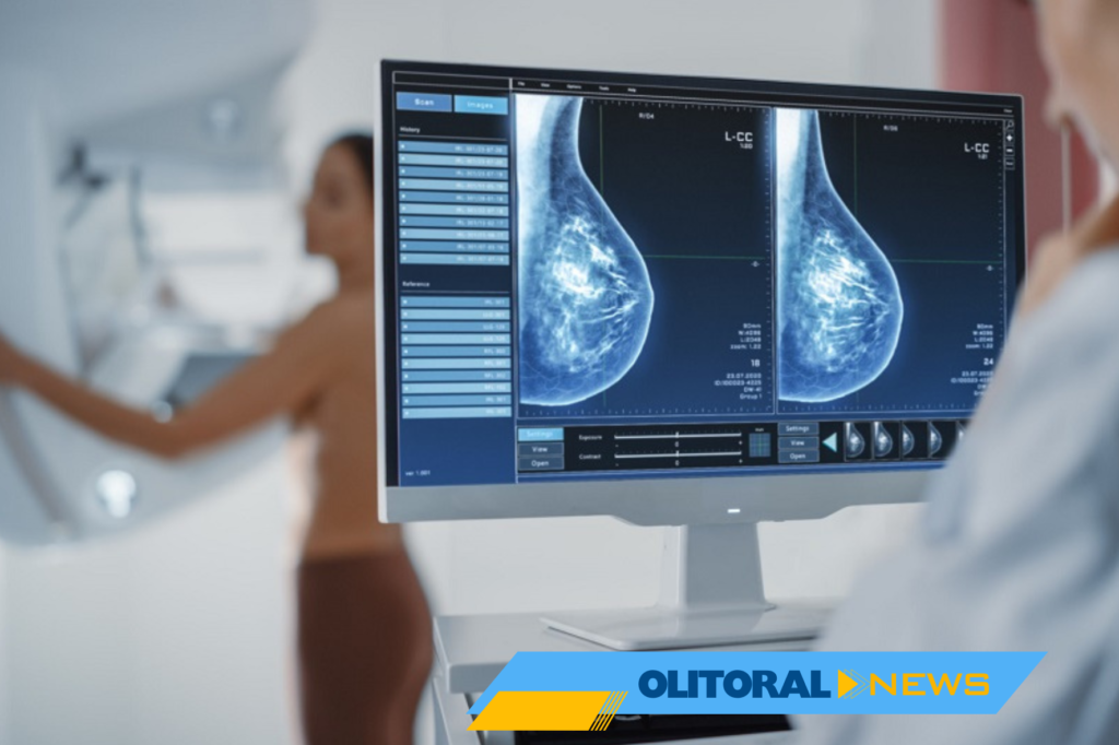 Mutirões de ultrassonografia beneficiam 130 mulheres em Cachoeiro